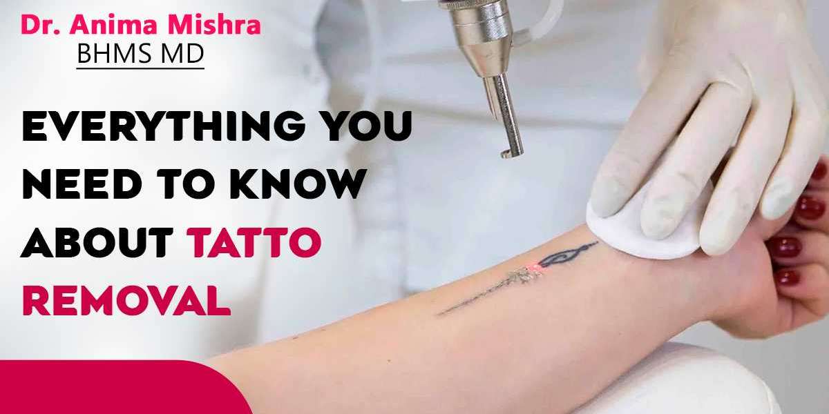 Unveiling the Canvas: The Best Tattoo Removal Clinic in Indirapuram with Dr. Anima Mishra