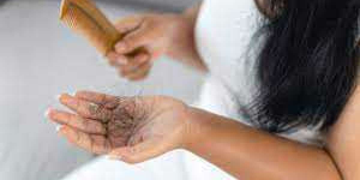 Hair Loss Treatment in Indirapuram with Dr. Anima Mishra