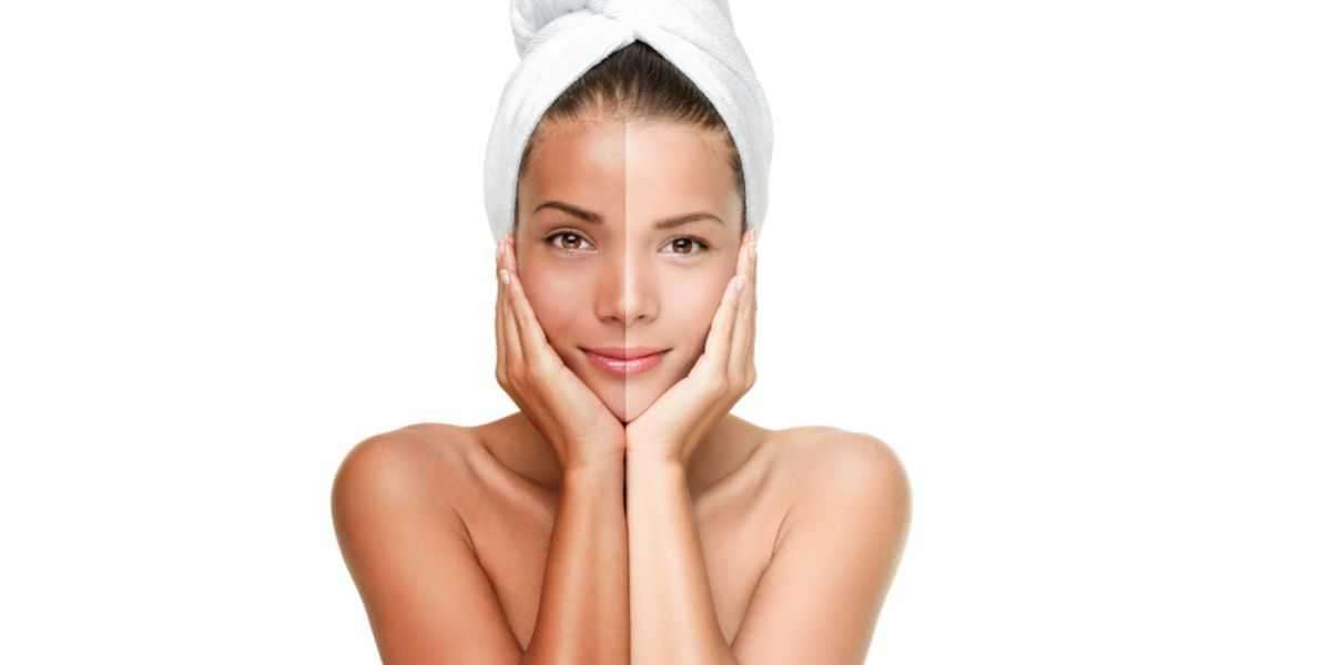 10 Myths and Facts About Skin Whitening Cream