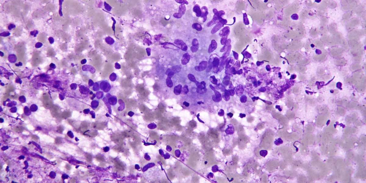 Histology and Cytology Market Share, Top Companies, Industry Growth Rate, Research Report 2024-32