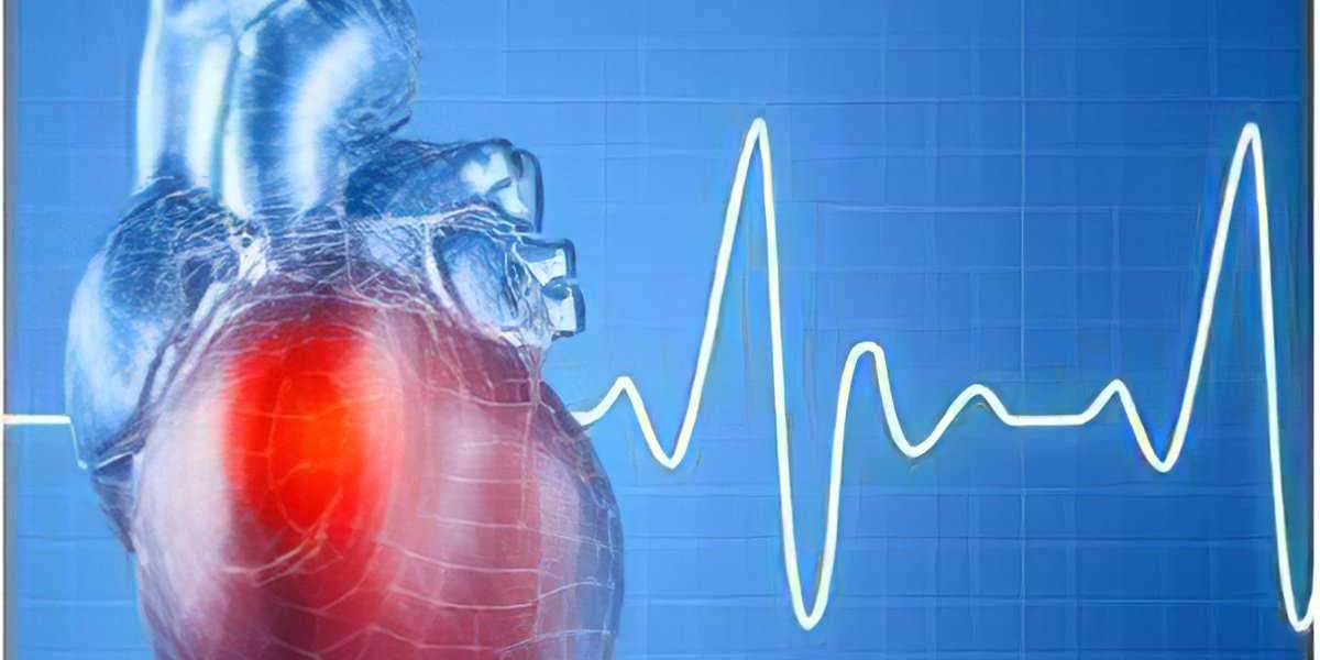 Atrial Fibrillation Devices Market Key Details and Outlook by Top Companies Till 2031