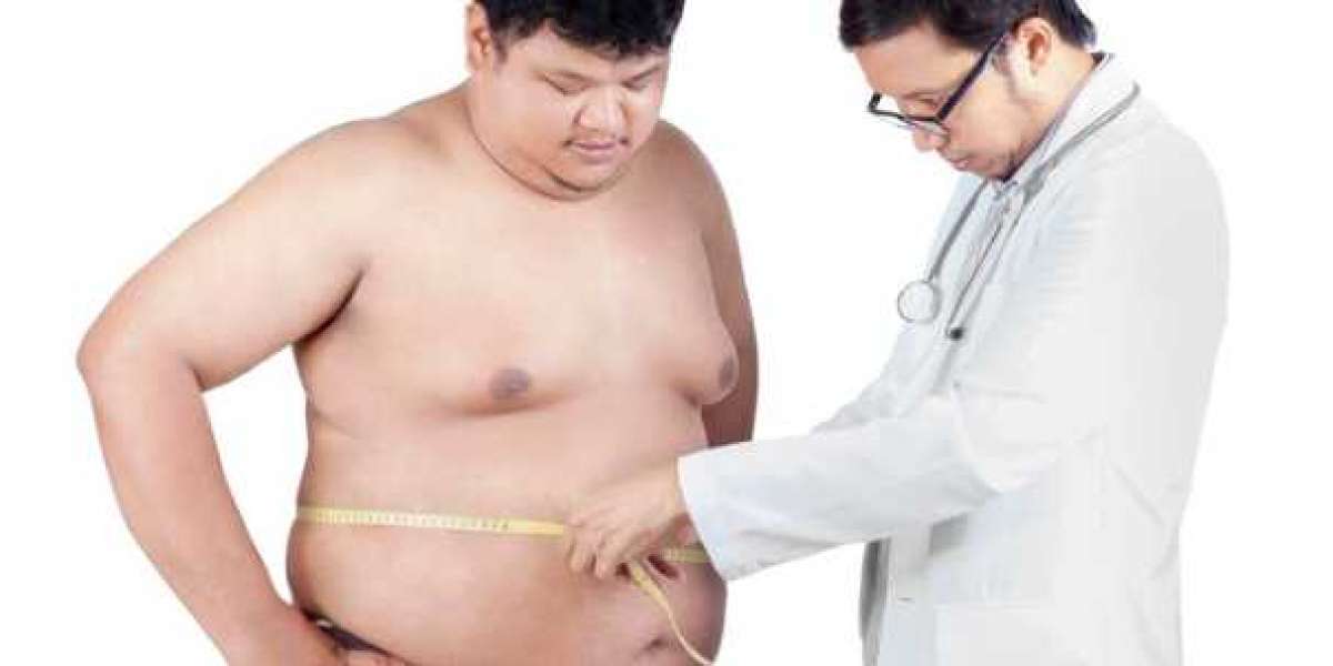 Dr Tarun Mittal | Best Obesity Surgery in Delhi